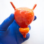 Peran Kebiasaan Sehari-hari dalam Menjaga Kesehatan Prostat