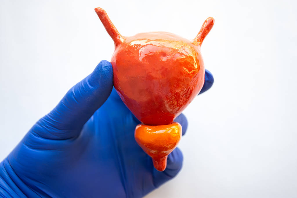 Peran Kebiasaan Sehari-hari dalam Menjaga Kesehatan Prostat